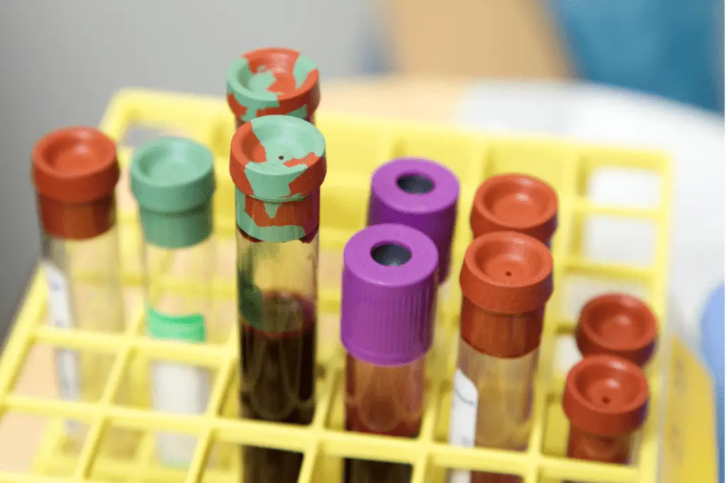 Blood specimens are another for sampling taken by officials for testing 